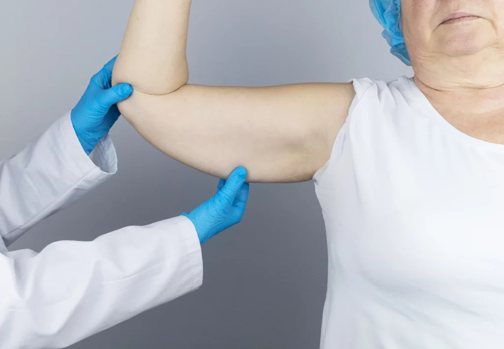 Brachioplasty (Arm Lift) in Plano, Desoto, TX by Noble Cosmetic Surgery