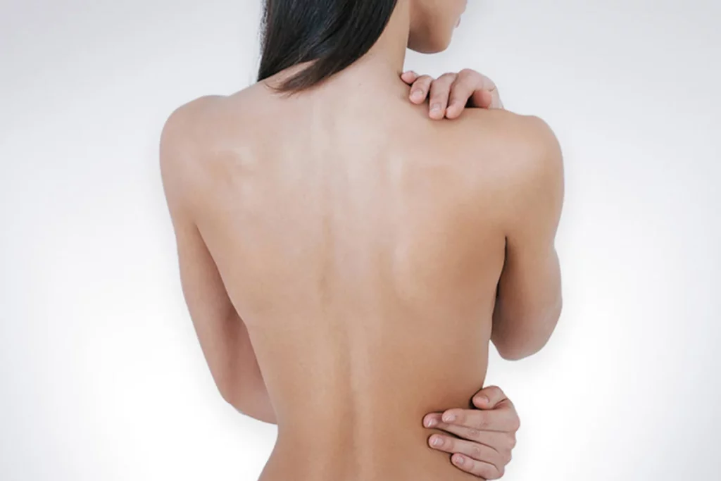 Back Lift in Plano and by Noble Cosmetic Surgery | Back Lift near Plano TX