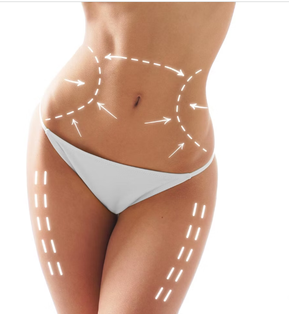 Best Liposuction Surgeon in TX